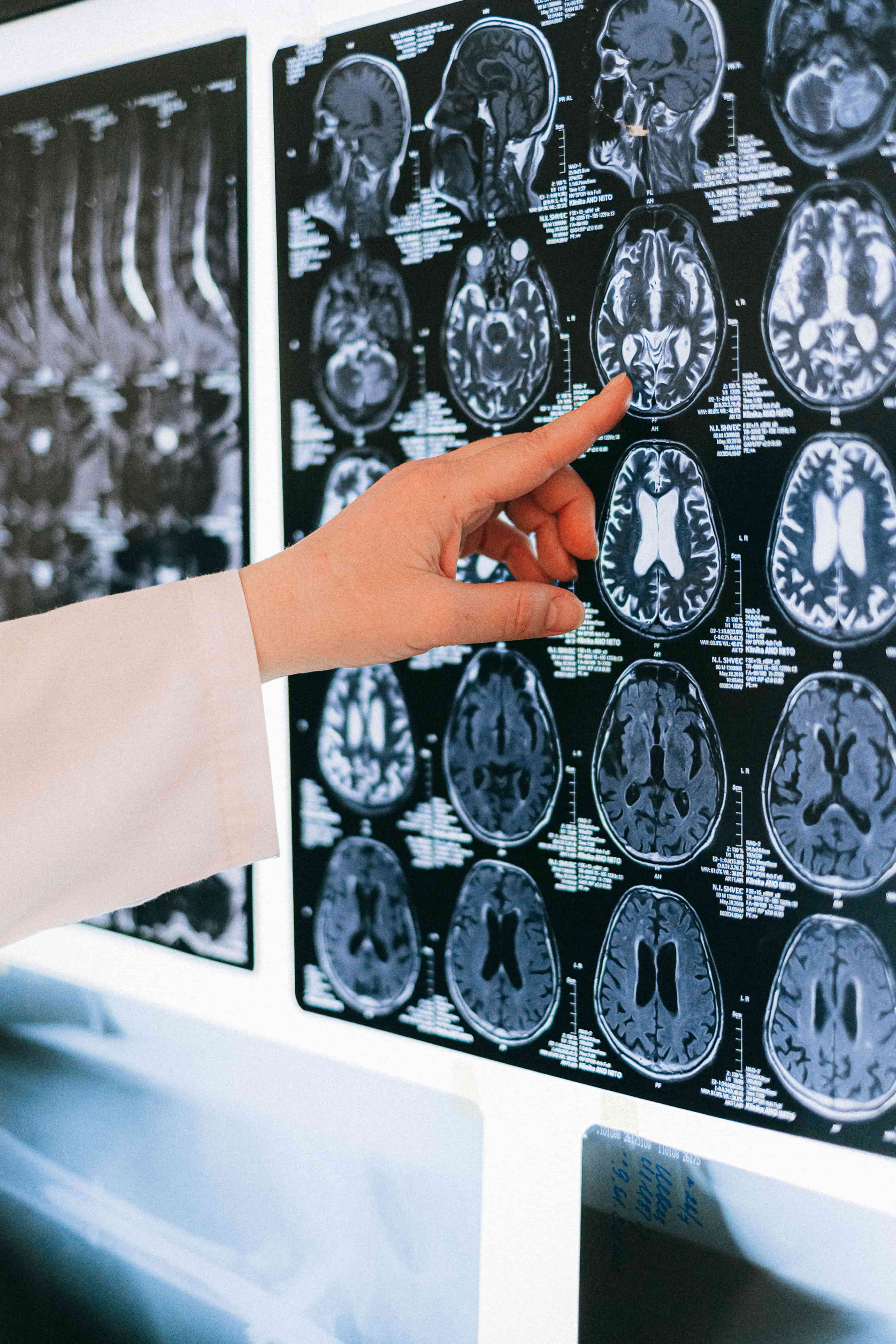 Konsultacja neurologiczna
